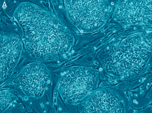 embryonic stem cells