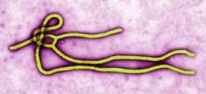 Transmission electron micrograph (TEM) of an Ebola virus virion.